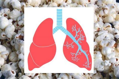 Popcorn Lung Definition 5 Causes And Symptoms 2024