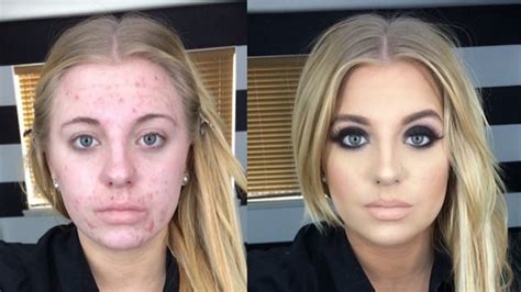 This Womans Before And After Photo Became A Nasty Internet Meme And