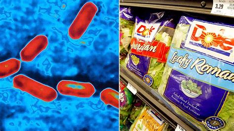 What Is Listeria Infection Symptoms Causes Diagnosis Treatment And