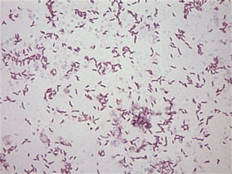 Campylobacter Jejuni Stepwards