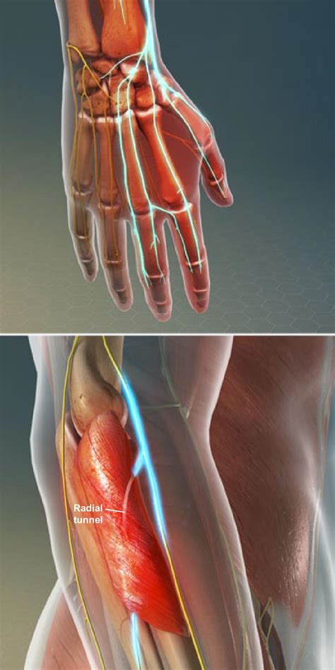 Radial Nerve Anatomy Radial Nerve Palsy And Radial Nerve Injury In Images