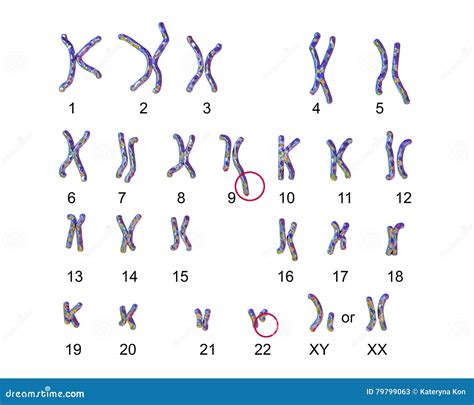 Philadelphia Chromosome Karyotype Stock Illustration Illustration Of