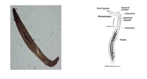Male Worm Of Bilharziella Sp Left Photograph Right Drawing