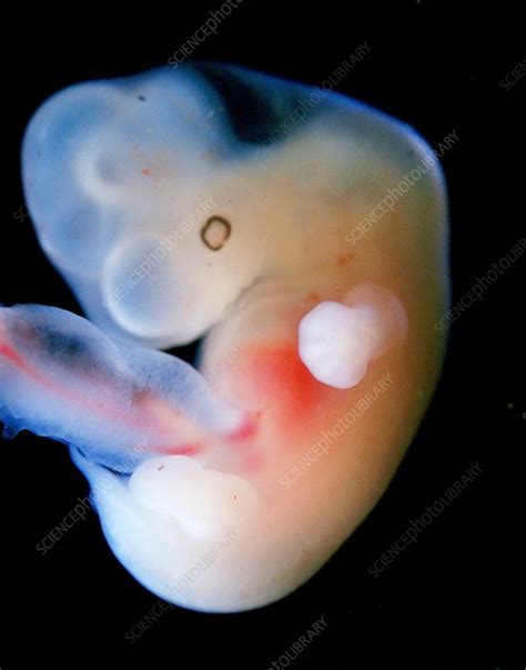Embryo At Five Weeks Light Micrograph Stock Image C0487866