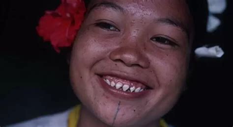 The Tradition Of Sharpening Teeth In Mentawai Believed To Make Women
