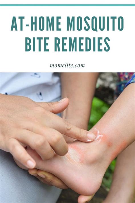 At Home Mosquito Bite Remedies