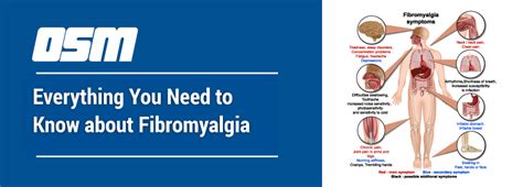 Everything You Need To Know About Fibromyalgia Orthopedic And Sports Medicine