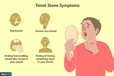 What To Do About Cryptic Tonsils
