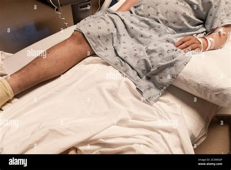 Torso And Leg Of An Amputee Man In A Hospital Bed Sick Disabled