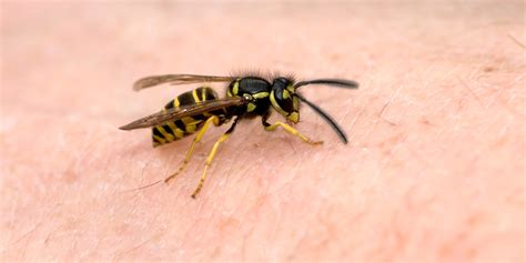 Bee Stings And Wasp Stings 7 Tips To Prevent These