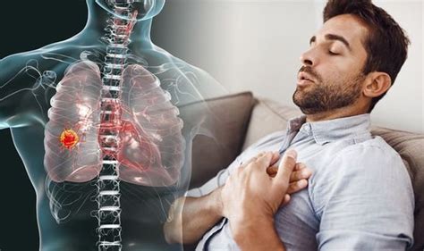 Lung Cancer Symptoms A Recurring Health Problem Could Signal The