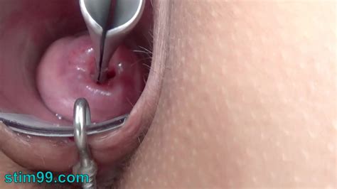 Extraordinary Cervix Toying With Injection Iron Shackle In Uterus Zb Porn