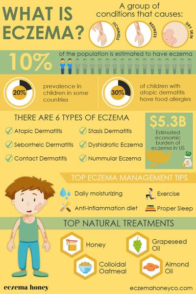 The Ultimate Guide To Eczema Eczema Honey Co
