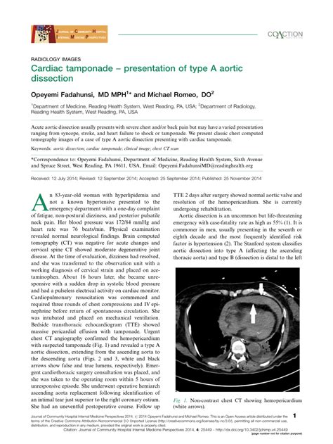 Pdf Cardiac Tamponade Presentation Of Type A Aortic Dissection
