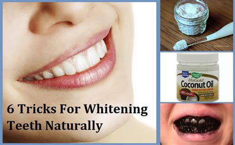Most stains are caused by foods and drinks, and yellowness can also be caused by your diet. Tooth Whitening - Natural Ways To Whiten Teeth At Home ...
