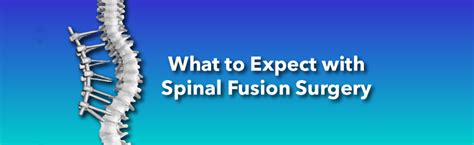 Spinal Fusion Surgery For Scoliosis What It Is And What To Expect