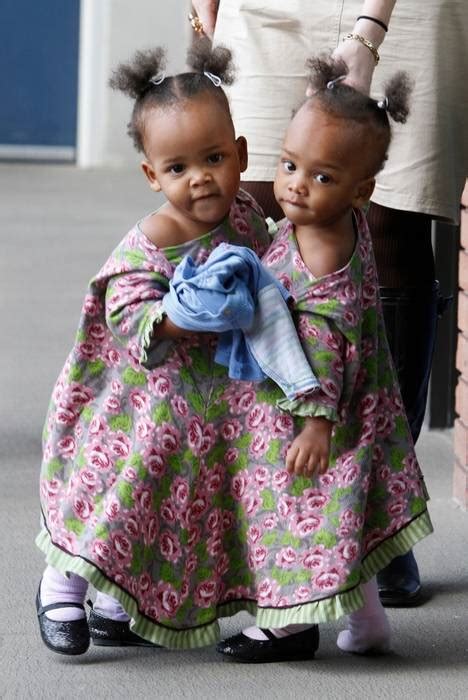 Conjoined Twins Undergo Separation Surgery In Virginia