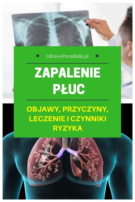 Zapalenie P Uc U Dziecka Przyczyny Objawy Leczenie Powik Ania Hot Sex Picture