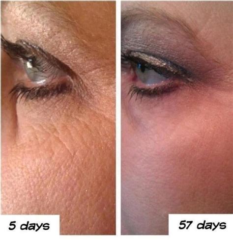Get Results From Your Age Defying Skin Care Clinical Tests Prove