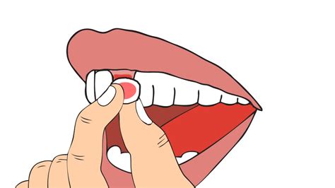 How long does a loose tooth take to heal? How to Pull out a Loose Tooth: 13 Steps (with Pictures ...