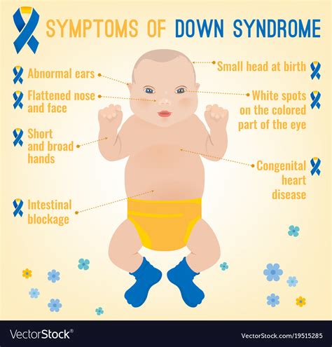 Down Syndrom Symptoms Royalty Free Vector Image