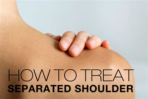 Shoulder Separation Symptoms Causes Treatment By Shoulder Separation