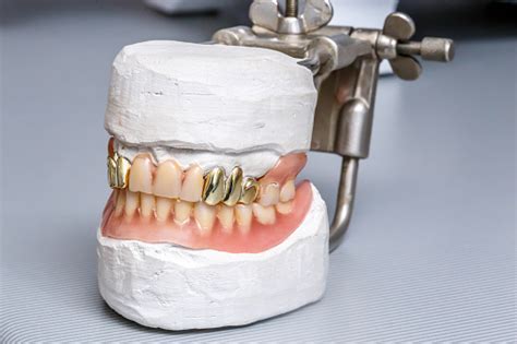 Check spelling or type a new query. Dental Gold Teeth Prosthesis Clay Mold Human Gums Model ...