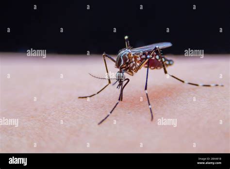 Striped Mosquitoes Are Eating Blood On Human Skin Dangerous Malaria