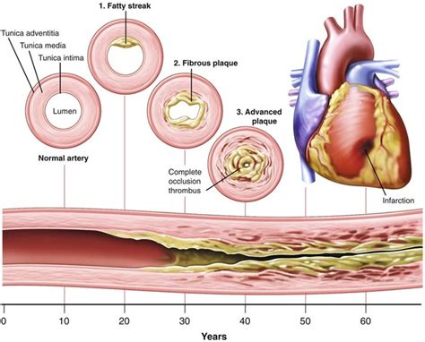 Cardiovascular Disease Oncohema Key