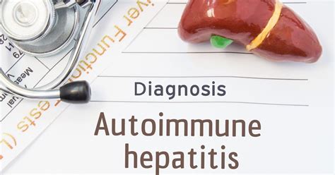 Symptoms And Causes Of Autoimmune Hepatitis Facty Health
