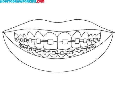 How To Draw Braces Easy Drawing Tutorial For Kids