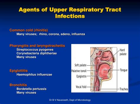 Ppt Respiratory Tract Infections Rti Powerpoint Presentation Free Download Id6612376