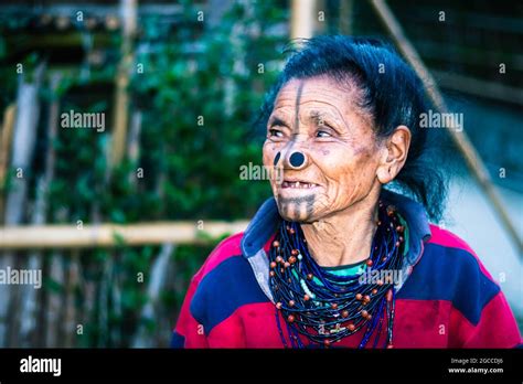 Apatani Tribal Women Facial Expression With Her Traditional Nose Lobes