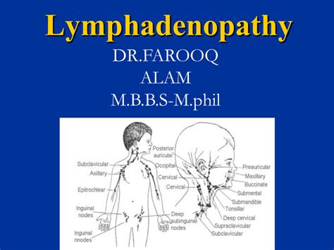 Lymphadenopathy In Children