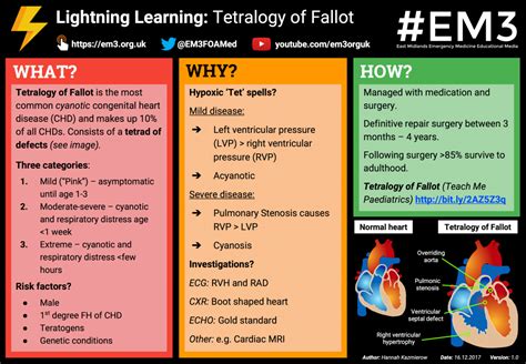Box diagram illustrating component lesions seen in tetralogy of fallot: Tetralogy of Fallot- Pathophysiology -Managment ...