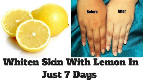 How To Whiten Skin With Lemon In Just 7 Days Lemon Facial At Home