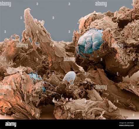 Scabies Mites Coloured Scanning Electron Micrograph Of Two Itch Mites