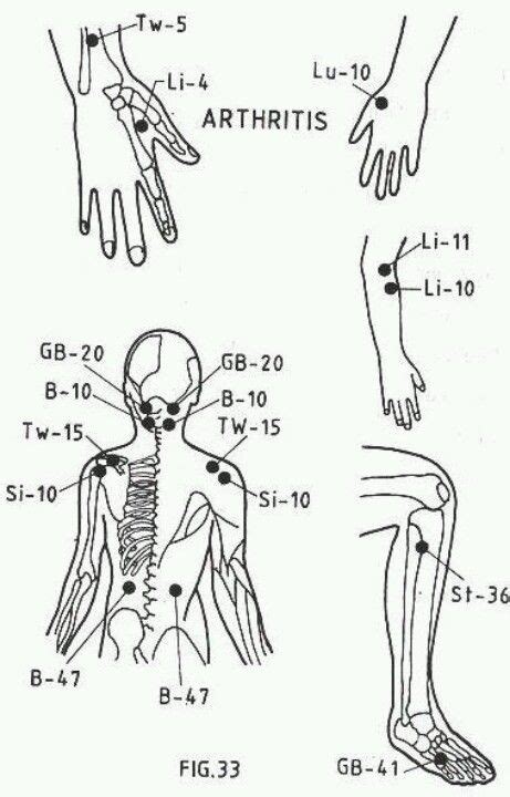 Acupuncture Acupressure Treatment Acupressure Acupressure Points