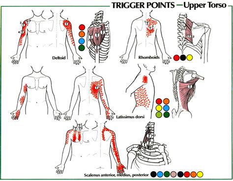 Trigger Points Shoulder Pain Southern Comfort Pinterest