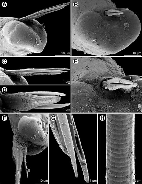 Philometra Tropica Sp Nov Scanning Electron Micrographs Of Male A