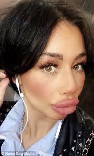 Liverpool Mother Who Spent K On Lip Fillers Says She Wants To Go Even