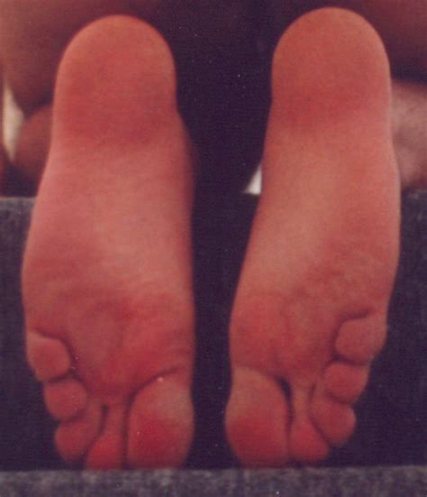 She goes the extra mile to make sure her feet look beautiful all the time. Soles | This is a picture of the soles of my feet taken a ...