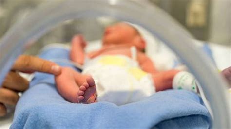 Terrible Bebé Prematuro Es Declarado Muerto En Dos Ocasiones Y Luego