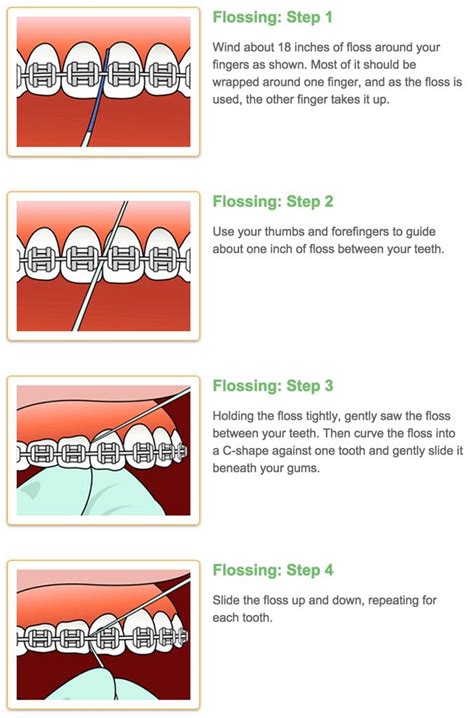 Whether you are using a manual toothbrush or an electrical one, you need to pay attention to the areas can i brush my teeth on the first day of braces? Braces Care — Douglas Nguyen Orthodontics