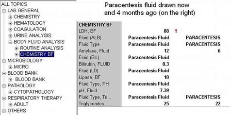 Clinical Notes Paracentesis A Step By Step Procedure Guide