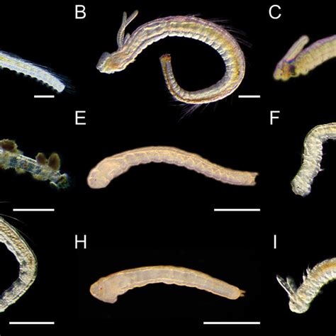 Light Micrographs Showing The Morphologies Of Living Spionid Larvae Of