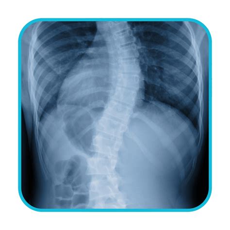 X Ray Bespoke Radiology Solutions