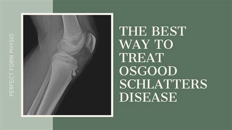 The Best Treatment For Osgood Schlatters Disease With Lisa Howell