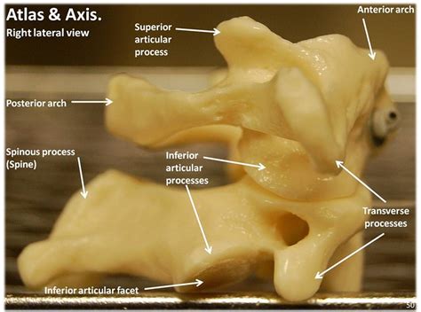 Atlas C1 And Axis C2 Vertebrae Lateral View With Labels Axial