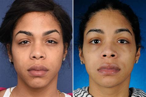 Oli London Before And After Dr Phil Makeup Makeup Vidalondon